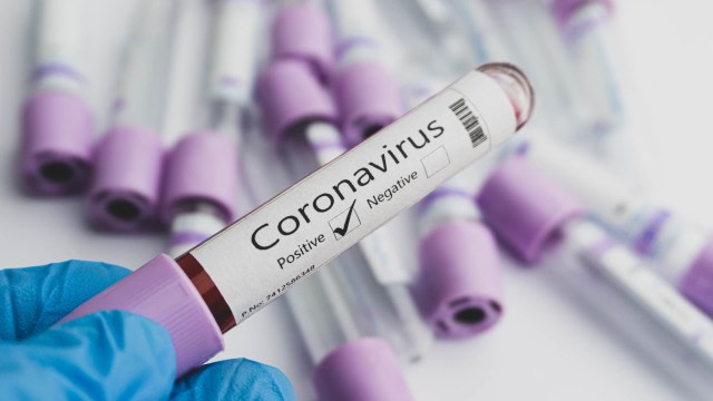 Ilustrasi positif terjangkit virus corona. Foto: Shutterstock