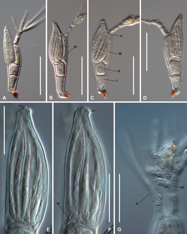 Troglomyces twitteri, spesies jamur parasit yang ditemukan berkat sebuah cuitan di Twitter. Foto: S. Santamaria, H. Enghoff, dan A. S. Reboleira