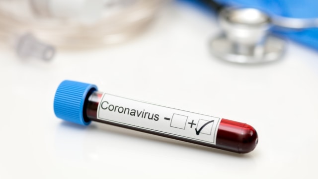 Ilustrasi positif terkena virus corona. Foto: Shutter Stock