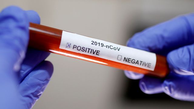 Ilustrasi tabung reaksi menunjukkan positif virus Corona. Foto: REUTERS/Dado Ruvic