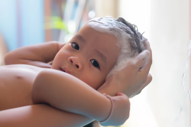 5 Tips Merawat Kulit Bayi agar Tetap Sehat (210433)