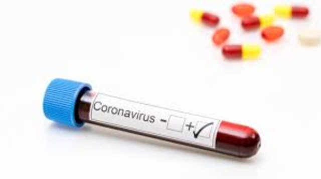 Ilustrasi positif terkena virus corona. Foto: Shutter Stock