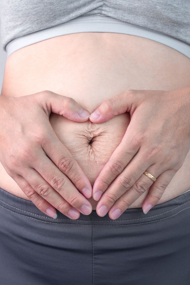 Ilustrasi kulit kendur usai melahirkan. Foto: Shutterstock