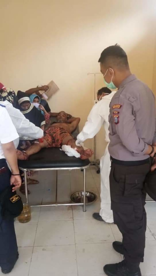 SYOFYAN (50), warga Desa Sepahat, Bandar Laksmana, Bengkalis, saat dirawat di Puskesmas setempat usai diterkam Harimau Sumatera, Kamis pagi, 4 Juni 2020. 