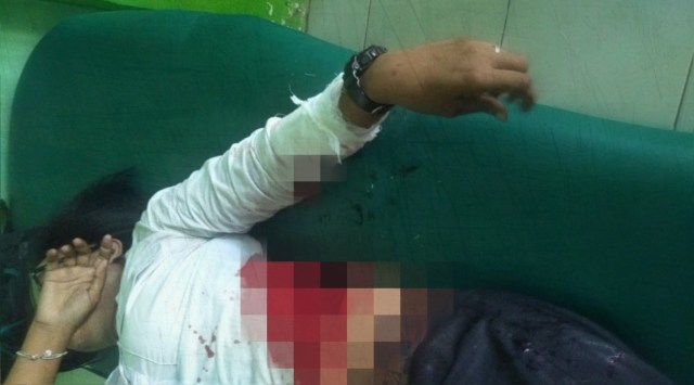 Korban saat ini masih dirawat di rumah sakit karena otot saraf lengan kirinya putus. Foto: Jambikita.id