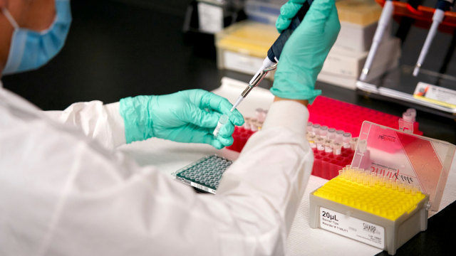 Petugas lab menyiapkan sampel sebelum pengujian virus corona (COVID-19). Foto: Cooper Neill/REUTERS