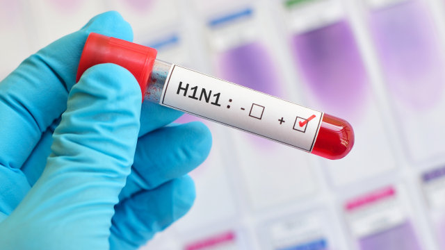 Ilustrasi flu babi atau H1N1. Foto: Shutterstock