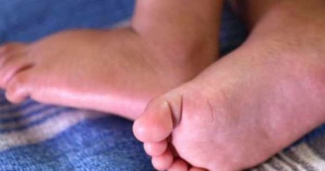 Ledakan Kelahiran Dikhawatirkan Terjadi di Bali Saat Pandemi COVID-19 (3229)