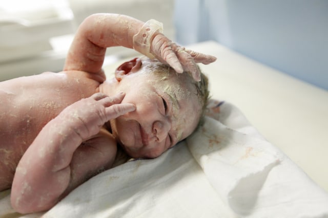 Vernix atau lapisan putih pada bayi baru lahir. Foto: Shutterstock