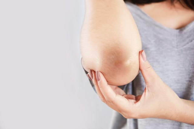 Cara Mencerahkan Kulit Lutut dan Siku dengan Teh Hijau. Foto: Shutterstock