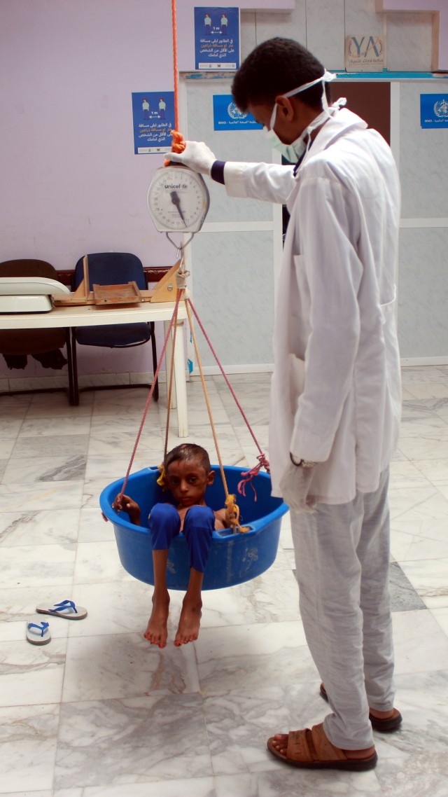 Seorang dokter menimbang anak laki-laki malnutrisi, Hassan Merzam Muhammad, di sebuah rumah sakit di distrik Aslam provinsi Hajjah, Yaman. Foto: Eissa Alragehi/REUTERS 