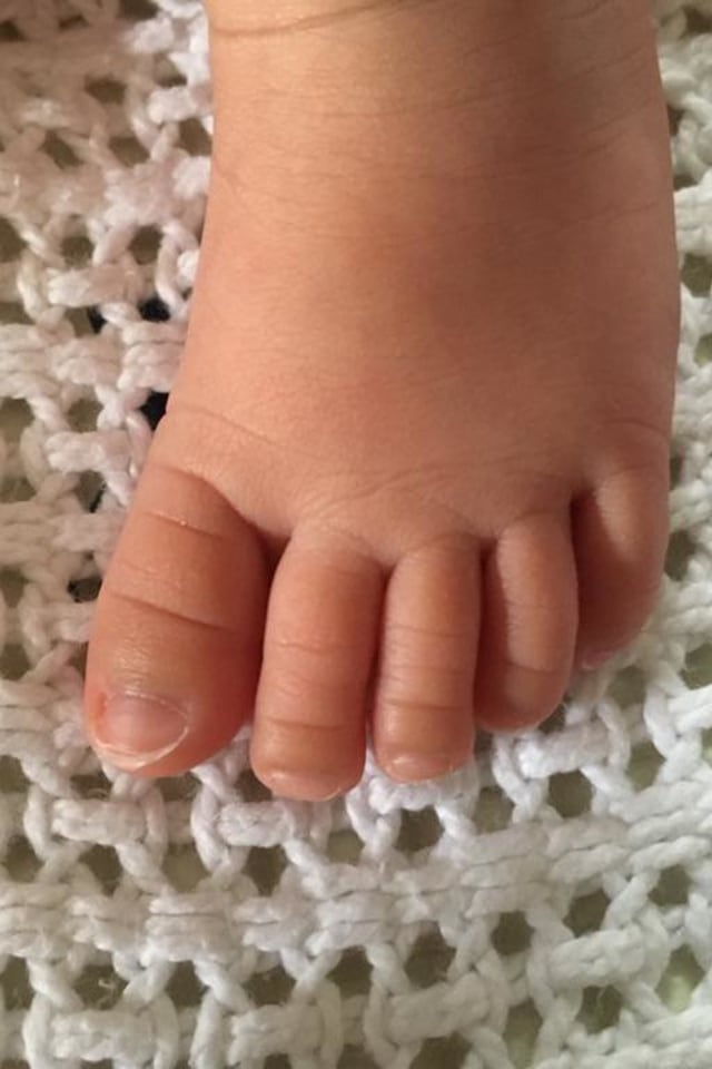 Ilustrasi kaki bayi Foto: Fitra Andrianto/kumparan