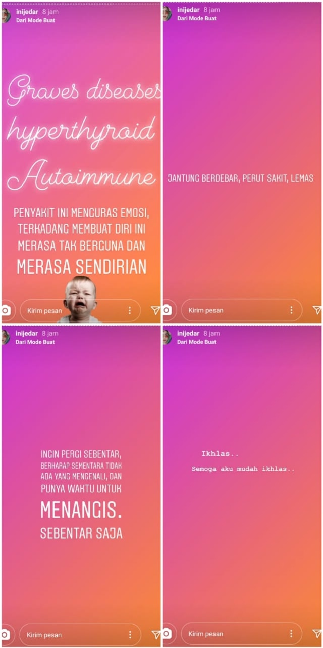Jessica Iskandar Curhat soal Penyakitnya: Kadang Membuat Diri Merasa Tak Berguna (1223506)