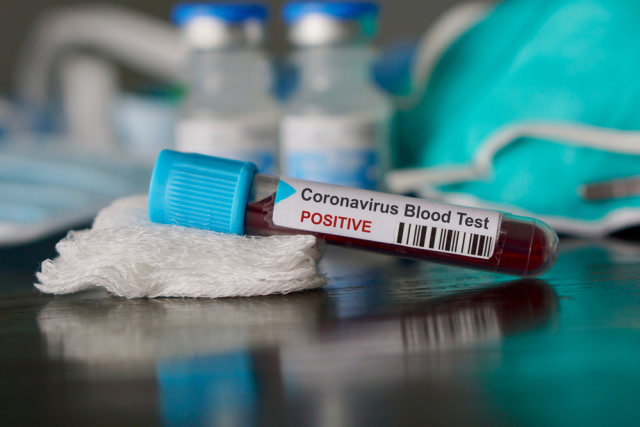 com-Ilustrasi tes darah yang positif corona. Foto: Shutterstock