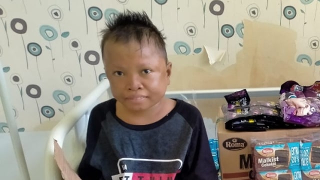 Dion Saputra (15), remaja yatim piatu penderita gizi buruk di Donggala, Sulawesi Tengah, kini mulai pulih dari penyakitnya. Foto: Istimewa