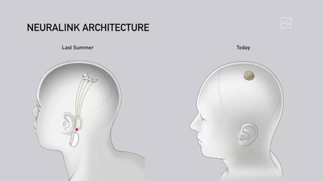Neuralink, Chip perekam otak Elon Musk. Foto: The Verge