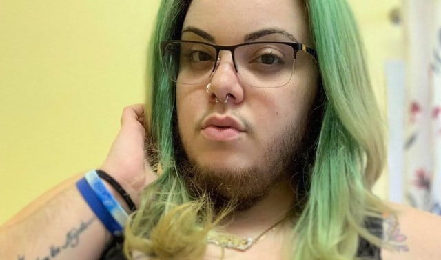 Alma Torres, pengidap sindrom ovarium polikistik Foto: Instagram: Bearded Beauty