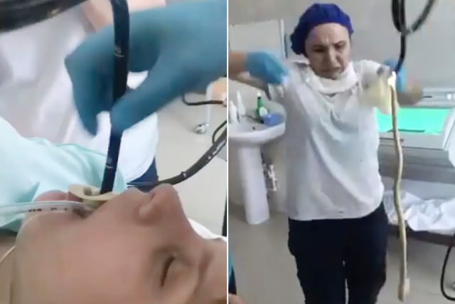 Detik-detik Dokter Keluarkan Ular 1,2 Meter dari Mulut Perempuan (44394)