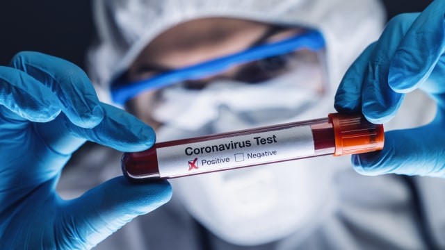 Ilustrasi positif terkena virus corona. Foto: Shutterstock 