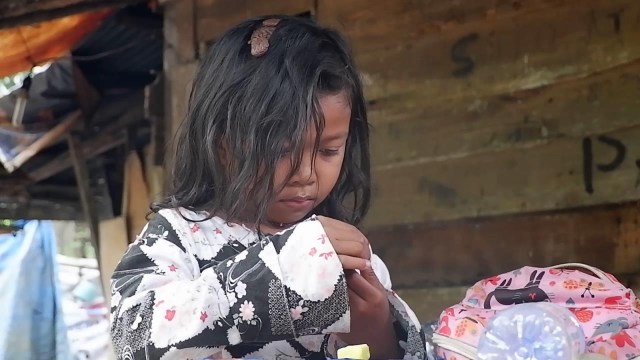Nurul Alfiani Azzahra, anak perempuan 6 tahun di Pekanbaru dengan kondisi daging tumbuh menyelimuti kepalanya.