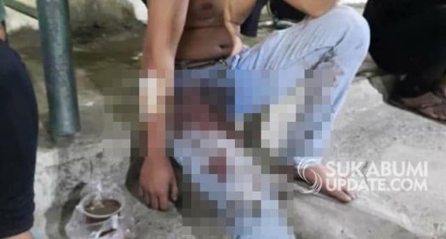 Kondisi korban pembacokan berinisial THP (24 tahun), warga Desa Cisolok, Kecaamatan Cisolok, Kabupaten Sukabumi, setelah dikeroyok orang tidak dikenal, Sabtu (12/9/2020) lalu. | Sumber Foto:Istimewa