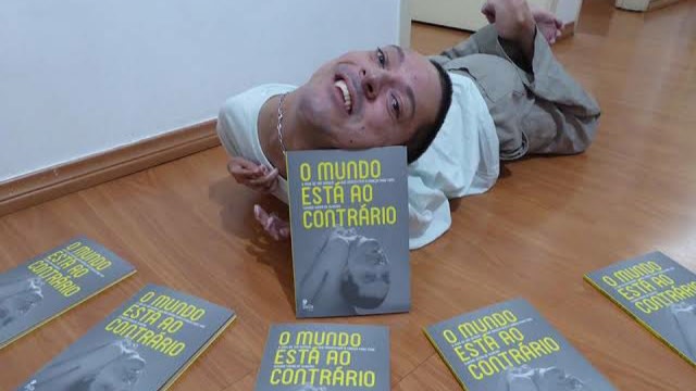 Kisah Claudio Oliveira, Motivator Dunia yang Terlahir dengan Kepala Terbalik (312856)