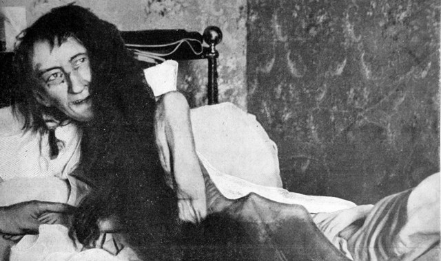 Kondisi Blanche Monnier saat ditemukan pada 23 Mei 1901. Tubuhnya kurus kering setelah dikurung 25 tahun oleh ibunya. Foto: Wikimedia Commons 