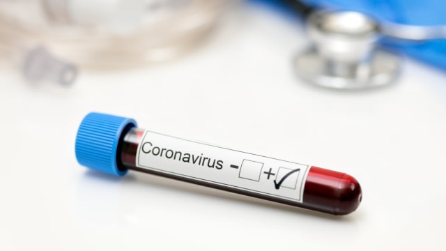 Ilustrasi positif terkena virus corona. Foto: Shutter Stock