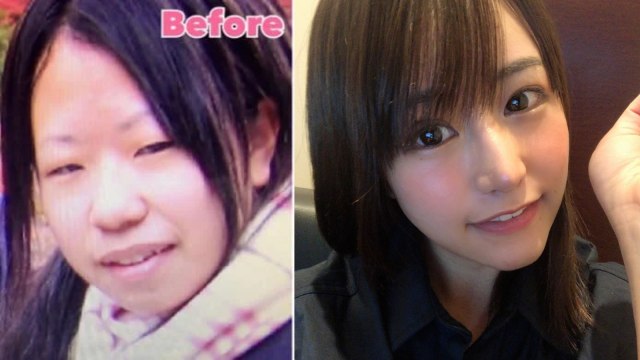 Viral Foto Perempuan Jepang Yang Perlihatkan Wajah Sebelum Dan Sesudah Oplas Kumparan Com