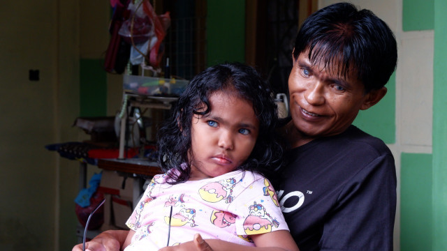 Inilah Anak dan Ayah Bermata Biru di Pekanbaru (79877)