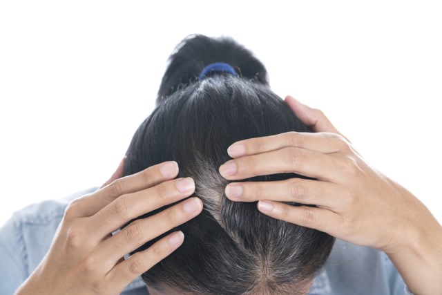 Rambut Uban Bermunculan, Harus Bagaimana Ya? (108951)
