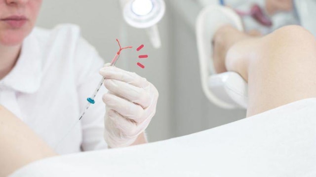 Lagi Program Hamil? Intip 3 Efek KB IUD bagi Suami (25519)