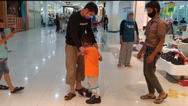 Berjalan 1 KM Hanya Dengan Sebelah Tangan, Kini Arsim Miliki Kaki Baru (12424)