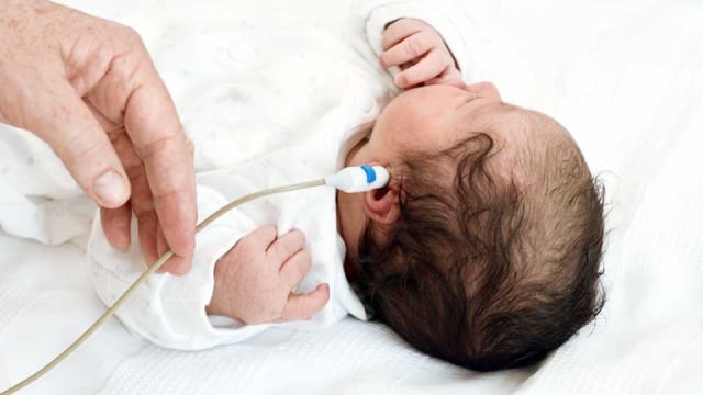 Tes OAE dapat dilakukan pada bayi yang berusia 2 hari.