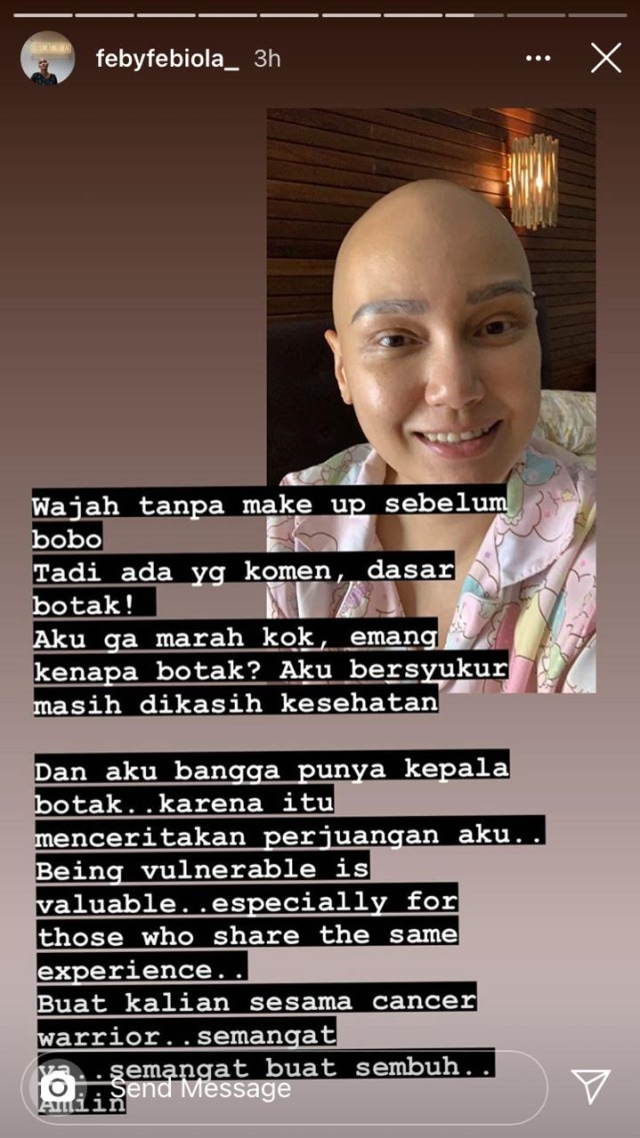Diejek karena Botak, Feby Febiola Beri Tanggapan yang Bikin Terharu (553765)