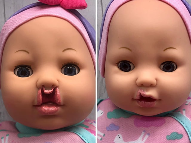 Demi Anak, Ibu di Inggris Buat Boneka dengan Bibir Sumbing dan Alat Bantu Dengar (1)