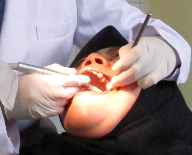 Ilustrasi periksa gigi. PDGI mencatat lebih dari 115 dokter gigi di Indonesia positif COVID-19, 11 diantaranya meninggal dunia. Foto: Masruroh/Basra﻿