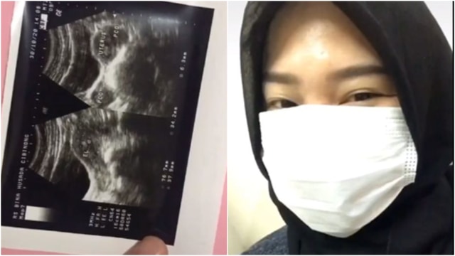 Perempuan tidak alami haid selama 10 bulan. (Foto: TikTok @ria.wnp)