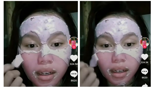 Pakai Masker Varian Rose, Wajah Wanita Ini Berubah Jadi Pink (51058)