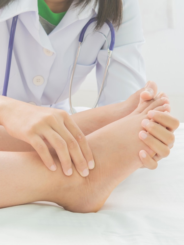 Ilustrasi kaki bengkak akibat gejala asam urat. Foto: Getty Images