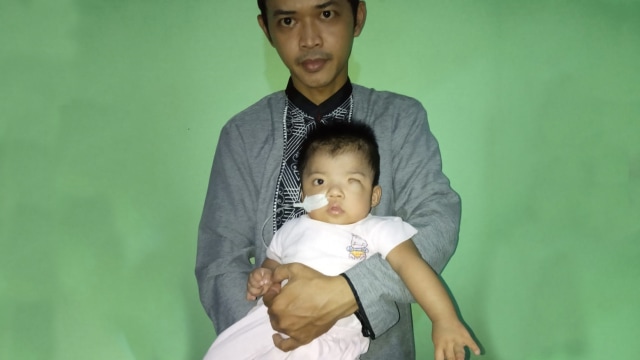 Achmad Farhan, bayi pengidap charge syndrom. Foto: Dok. Achmad Haryanto