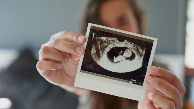 Ilustrasi usg bayi 10 minggu. Foto: Getty Images