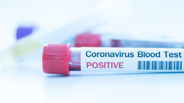 Ilustrasi positif terkena virus corona. Foto: Shutterstock