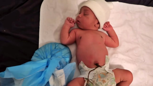 Melahirkan dengan Lotus Birth, Apa Maksudnya? (279529)