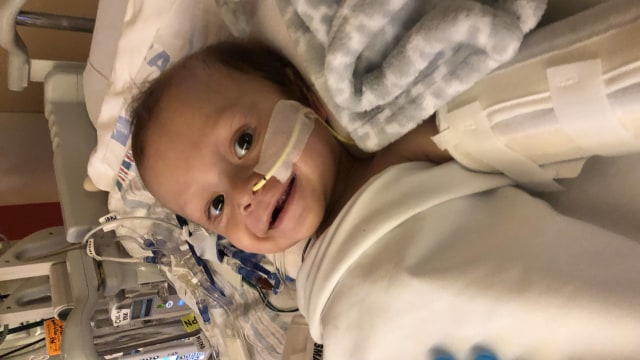 Jacob Cooper, bayi yang melakukan transplantasi organ hati. Foto: Dok. Children’s Hospital Los Angeles
