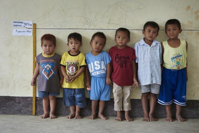 Stunting yang Dialami Anak Foto: dok UNICEF