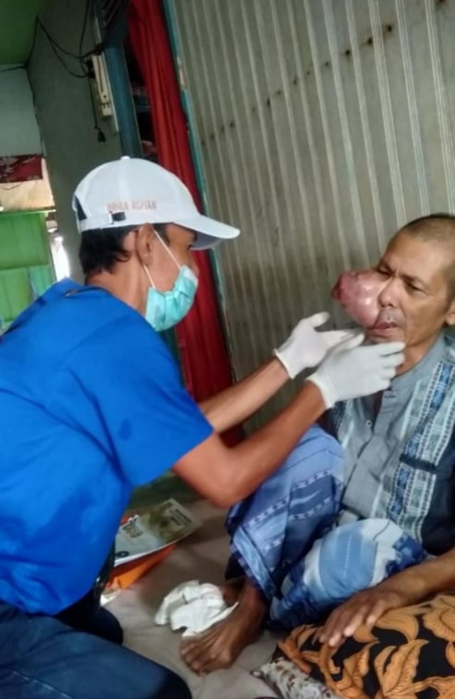 Indra Alfian perwakilan Lentera saat mengecek kondisi Ujang penderita tumor jinak sejah 2018 lalu. Foto: Komunitas Lentera.