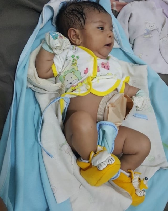 Bayi yang lahir tanpa anus. Foto: Arkadius Togo.