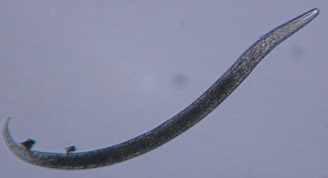 Plectus parvus atau cacing gelang.  Foto: blodsystems.org