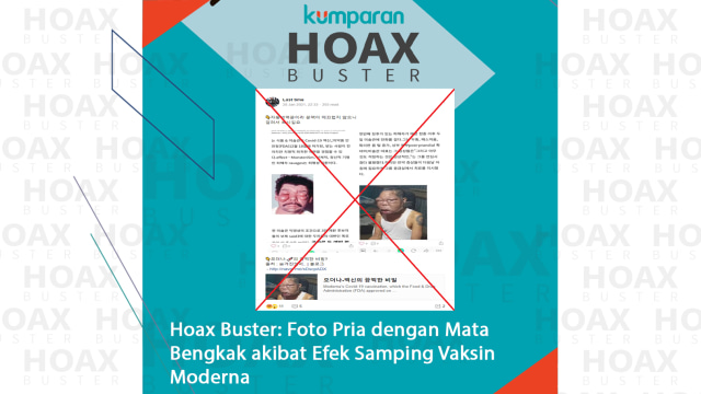 Hoaxbuster: Foto Pria dengan Mata Bengkak Akibat Efek Samping Vaksin Moderna (32167)